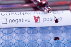 coronavirus-test-sierologico-simbolo